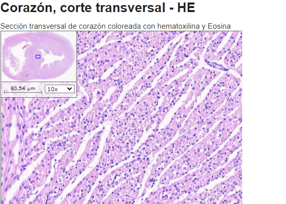 histología cardíaca