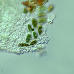 Diatomeas ( algas)