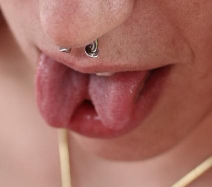 Deformación de la lengua